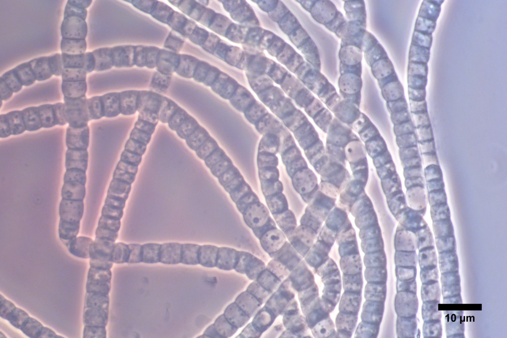 Kabelbacteriën